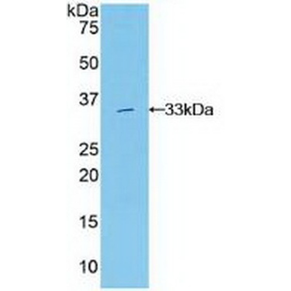 矢车菊苷α2(CENTa2)多克隆抗体