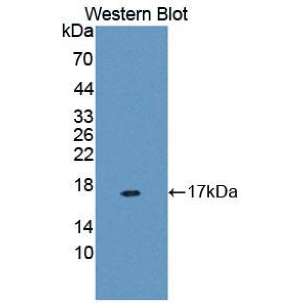 瘤变抑制因子14(ST14)多克隆抗体