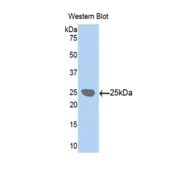 衰老关键蛋白5(FBLN5)多克隆抗体