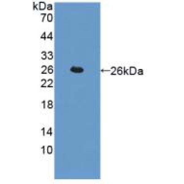 二级淋巴组织趋化因子(SLC)多克隆抗体