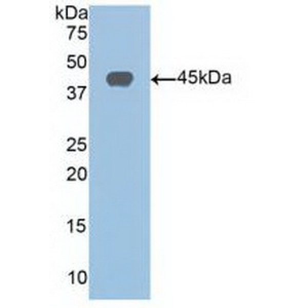 泛酸激酶1(PANK1)多克隆抗体