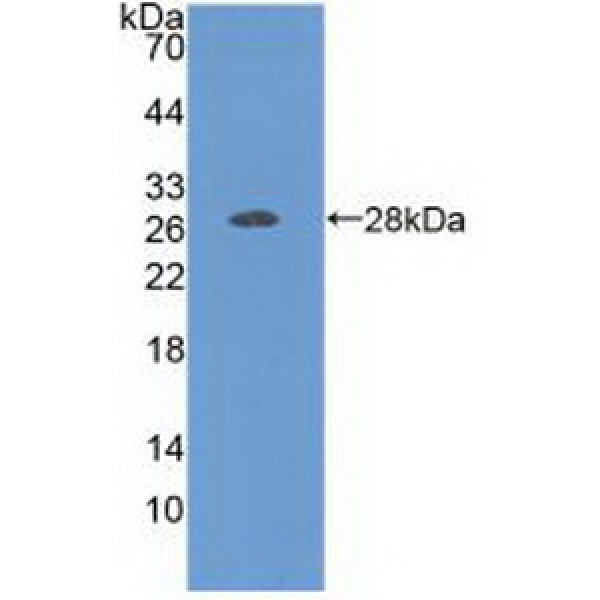 多功能蛋白聚糖(VS)多克隆抗体