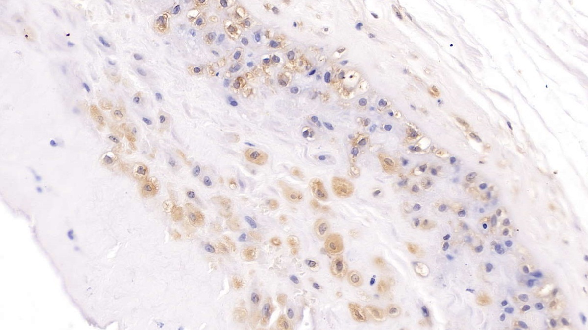 扭转原肠胚形成同源物1(TWSG1)多克隆抗体