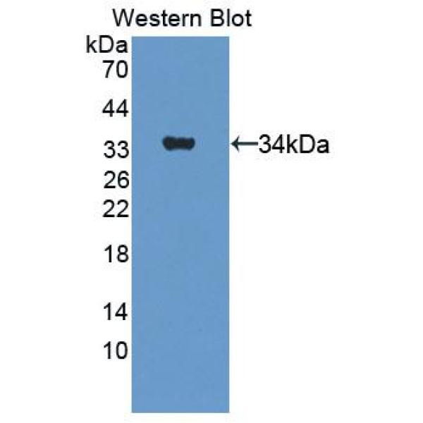 B/T-淋巴细胞衰减因子(BTLA)多克隆抗体