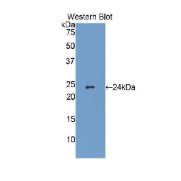 食管特定正常黏膜蛋白1(NMES1)多克隆抗体