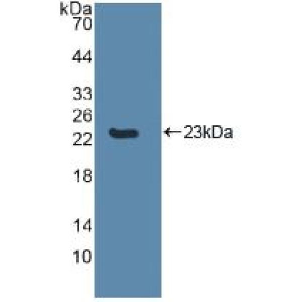 葡萄糖转运蛋白14(GLUT14)多克隆抗体