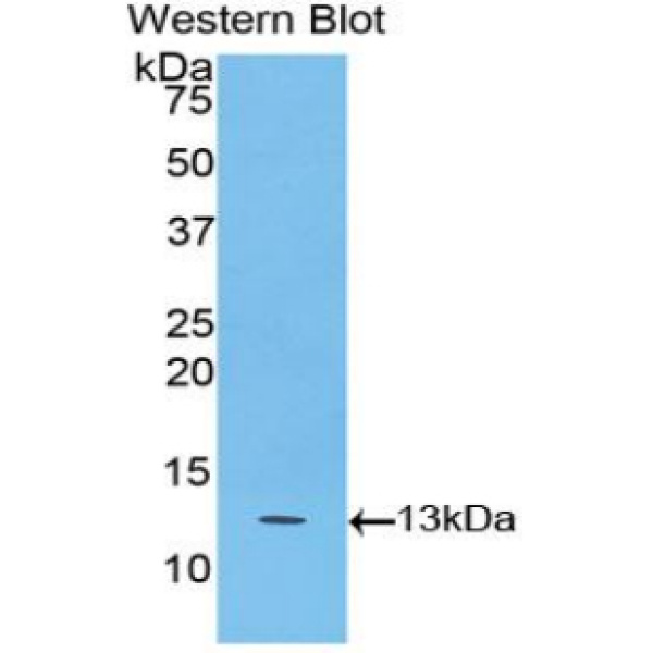 延伸蛋白B(ELOB)多克隆抗体