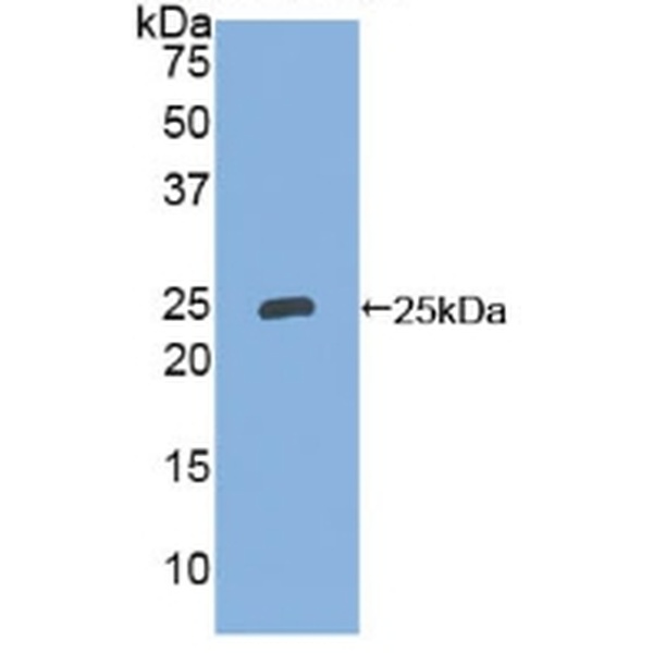 25kDa突触关联蛋白(SNAP25)多克隆抗体