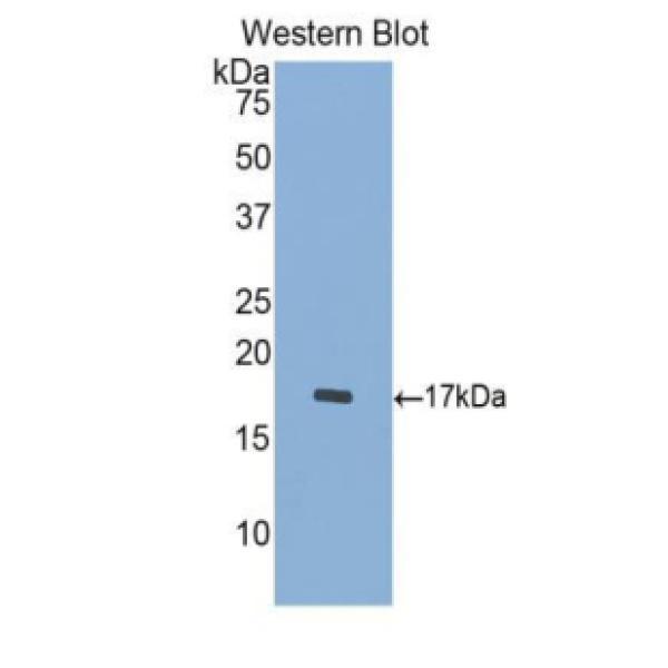 G蛋白β亚基样蛋白(GbL)多克隆抗体