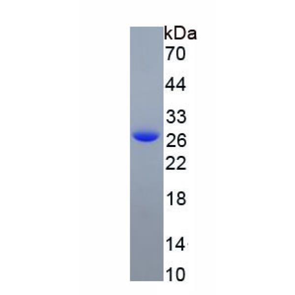 谷胱甘肽S转移酶θ1(GSTt1)重组蛋白(多属种)