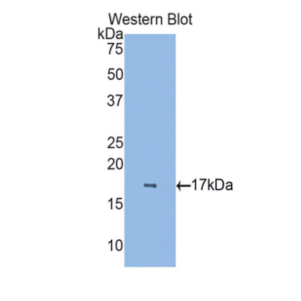 络丝蛋白(RELN)多克隆抗体