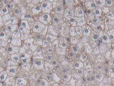 互联蛋白神经元中间丝蛋白&#945;(INa)多克隆抗体