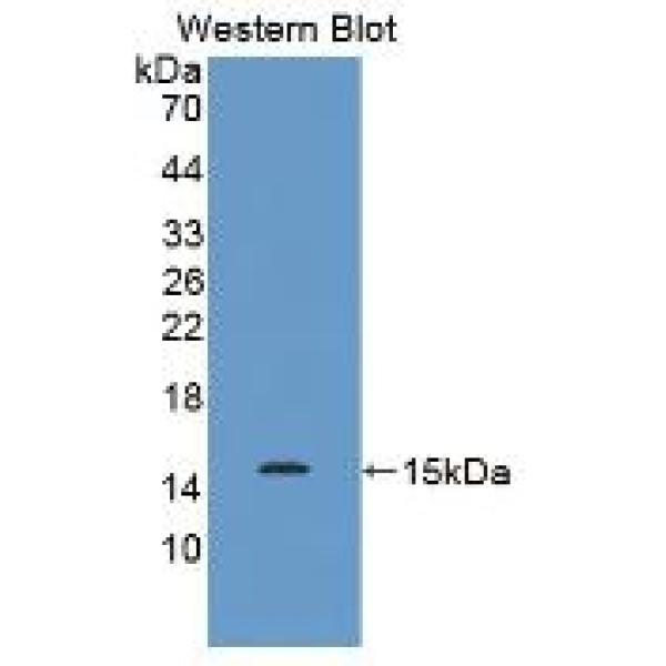 剑蛋白P60亚基A1(KATNA1)多克隆抗体