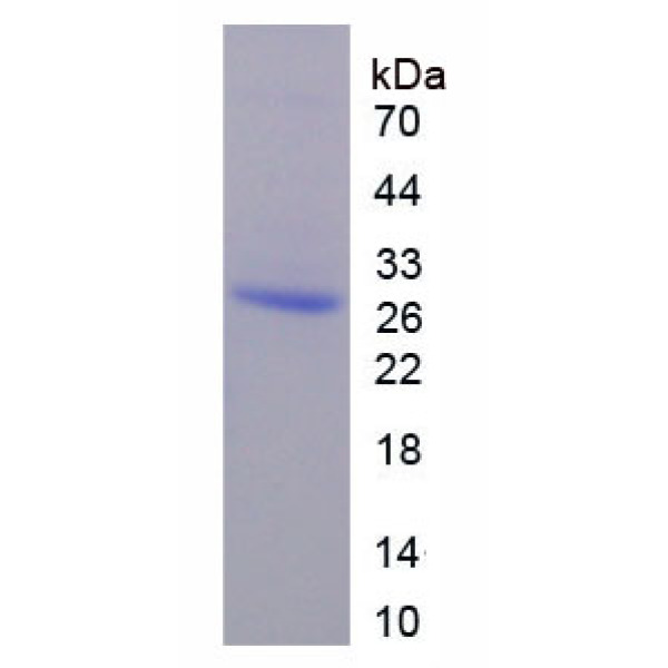 干燥综合征抗原B(SSB)重组蛋白(多属种)