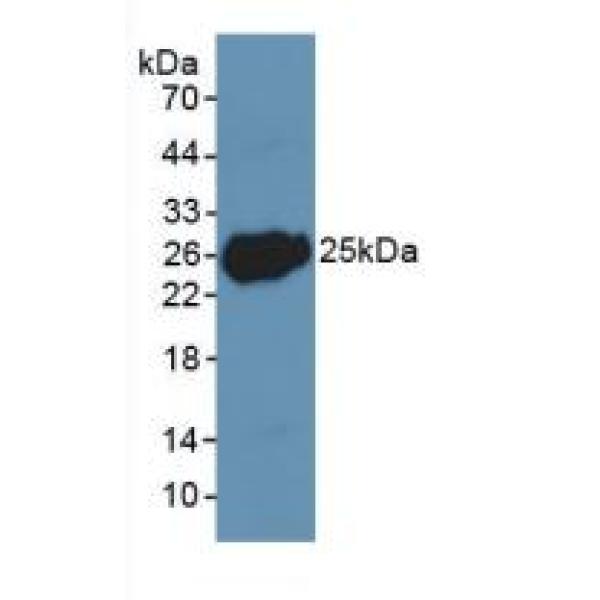 mRNA脱帽蛋白增强子1(EDC1)多克隆抗体
