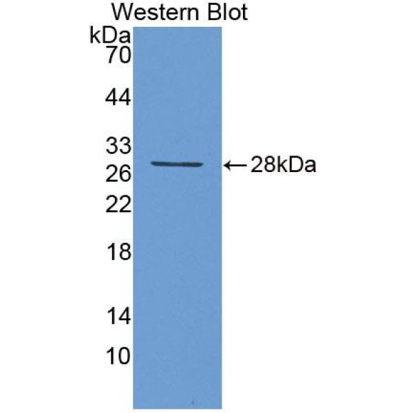 大型多功能肽酶7(LMP7)多克隆抗体