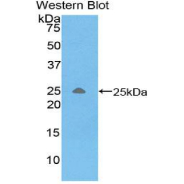 离子化钙结合适配分子1(IBA1)多克隆抗体