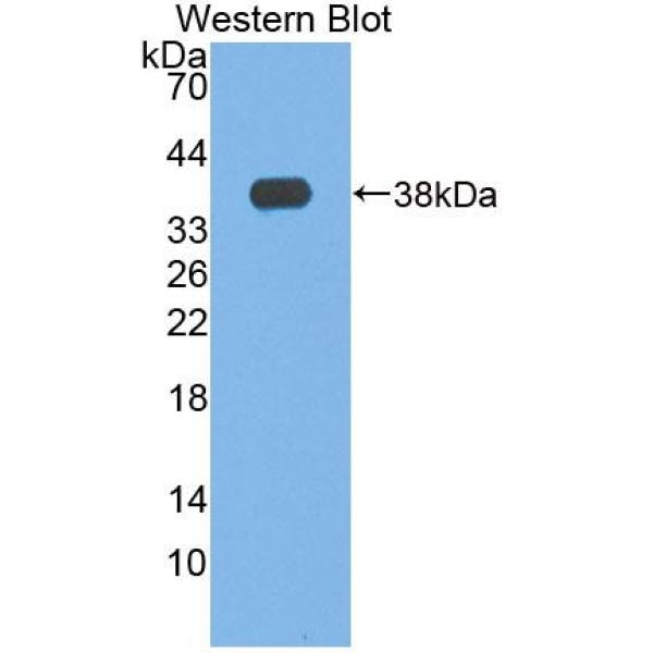 蛋白酶体亚基β6(PSMb6)多克隆抗体