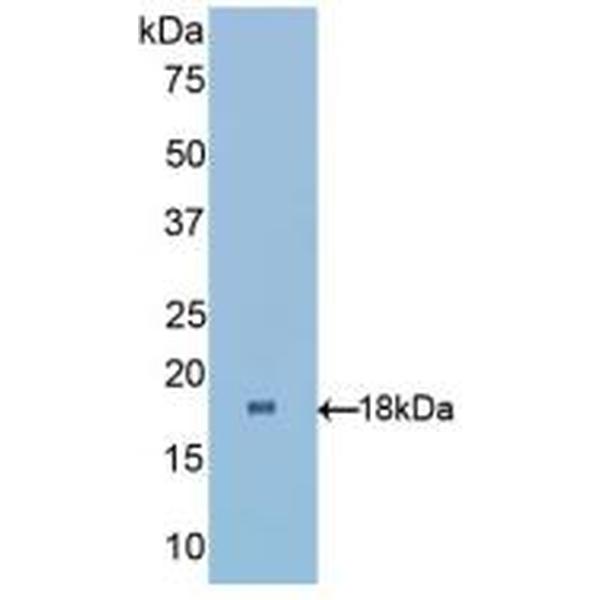 衰老关键蛋白2(FBLN2)多克隆抗体