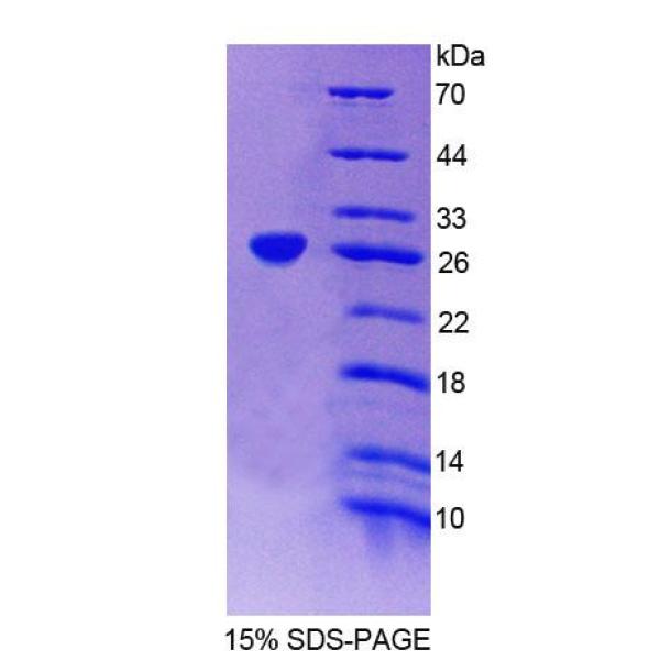 干燥综合征抗原A1(SSA1)重组蛋白(多属种)