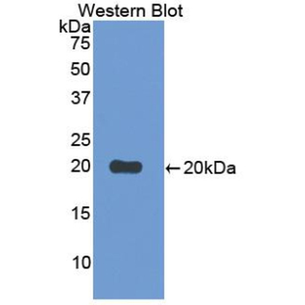 B-细胞κ-轻肽基因增强子抑制因子激酶β(IkBKb)多克隆抗体