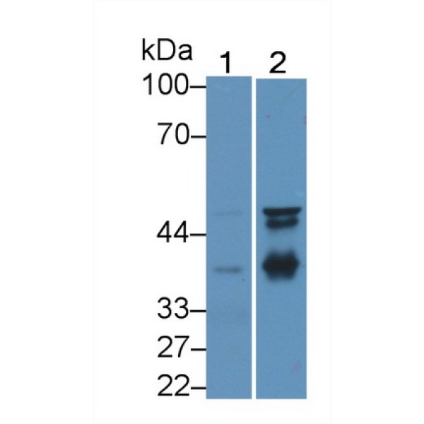 X-射线修复交叉互补蛋白2(XRCC2)多克隆抗体