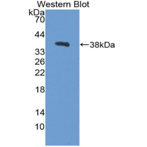 高温需求因子A1(HTRA1)多克隆抗体