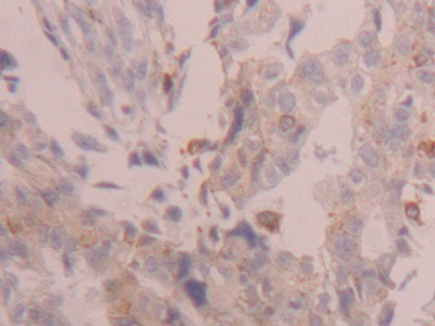 核有丝分裂器蛋白1(NUMA1)多克隆抗体