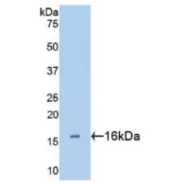 间隙连接蛋白β6(GJb6)多克隆抗体