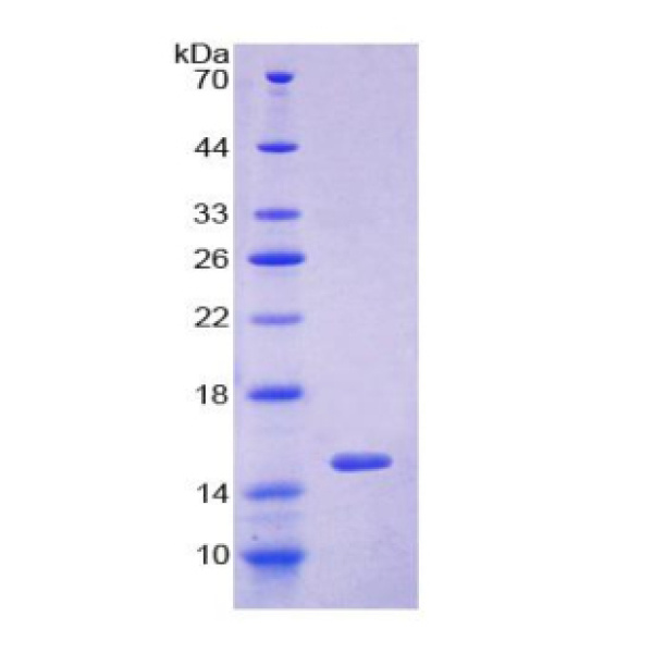 110kDa中心体蛋白(CEP110)重组蛋白(多属种)