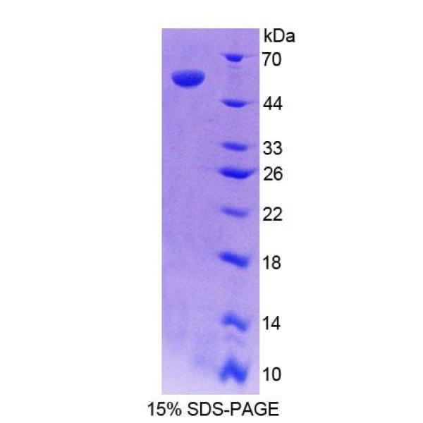 丝裂原激活蛋白激酶11(MAPK11)重组蛋白(多属种)