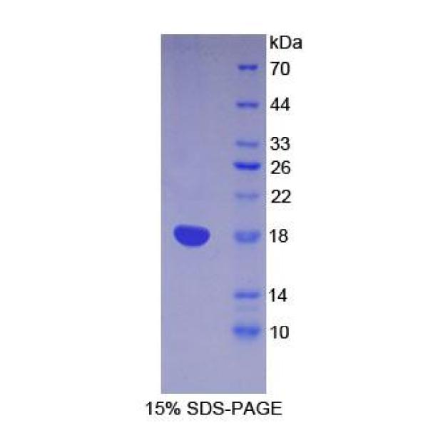 188kDa核孔蛋白(NUP188)重组蛋白(多属种)