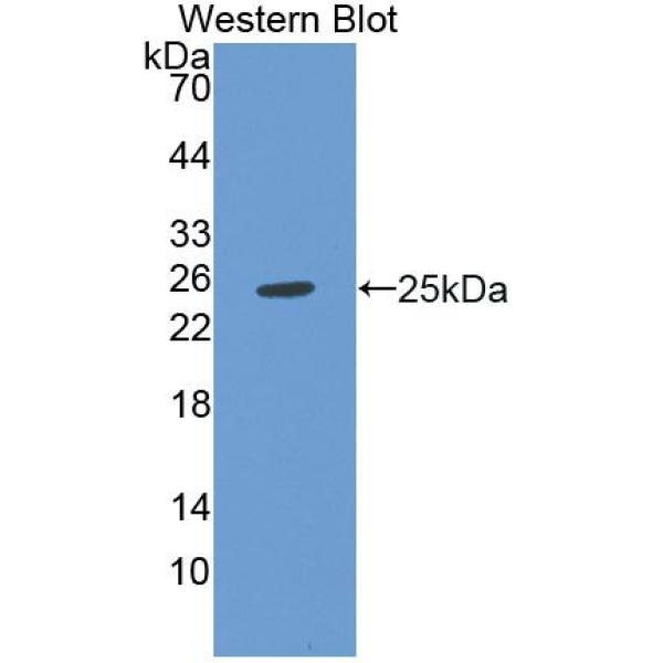 血管内皮生长因子145(VEGF145)多克隆抗体