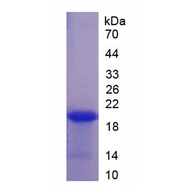 Z-DNA结合蛋白1(ZBP1)重组蛋白(多属种)