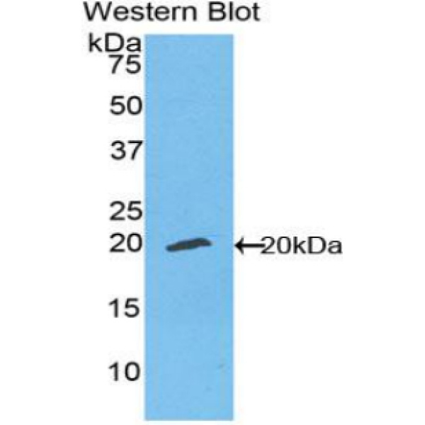 烟碱型胆碱受体α1(CHRNa1)多克隆抗体
