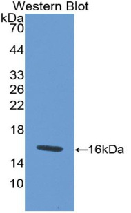 胱天蛋白酶7(CASP7)多克隆抗体