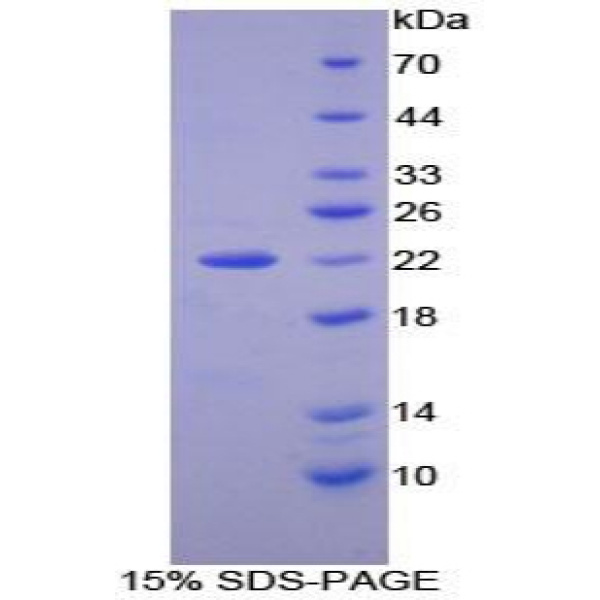 前折叠蛋白亚基2(PFDN2)重组蛋白(多属种)