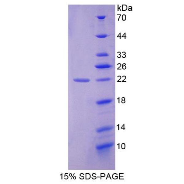 205kDa核孔蛋白(NUP205)重组蛋白(多属种)