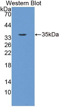 信号素4B(SEMA4B)多克隆抗体