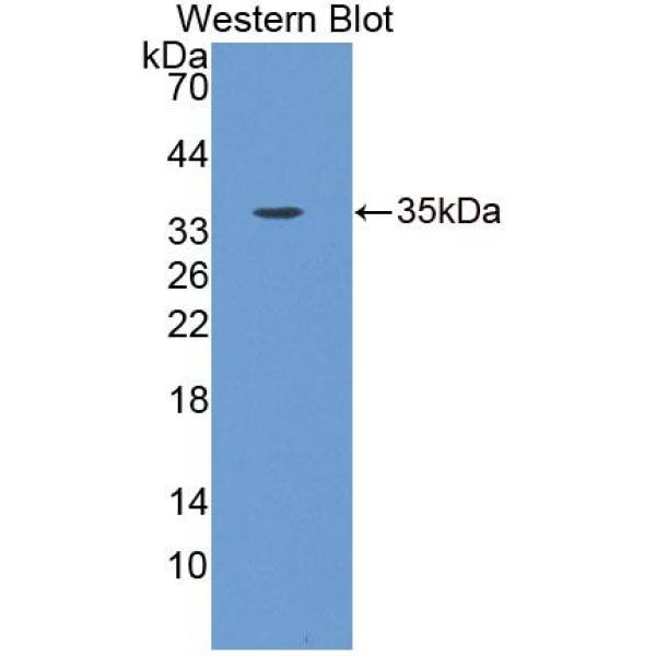 信号素4B(SEMA4B)多克隆抗体