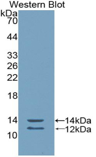水通道蛋白2(AQP2)多克隆抗体
