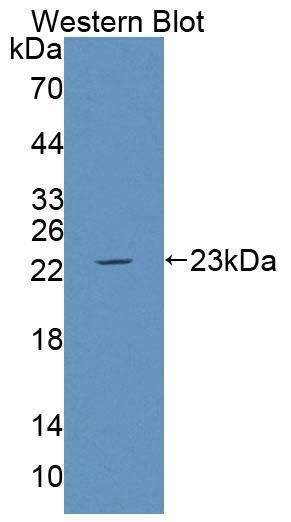 基质金属蛋白酶23A(MMP23A)多克隆抗体