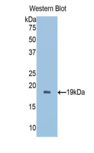 补体受体2(CD21)多克隆抗体