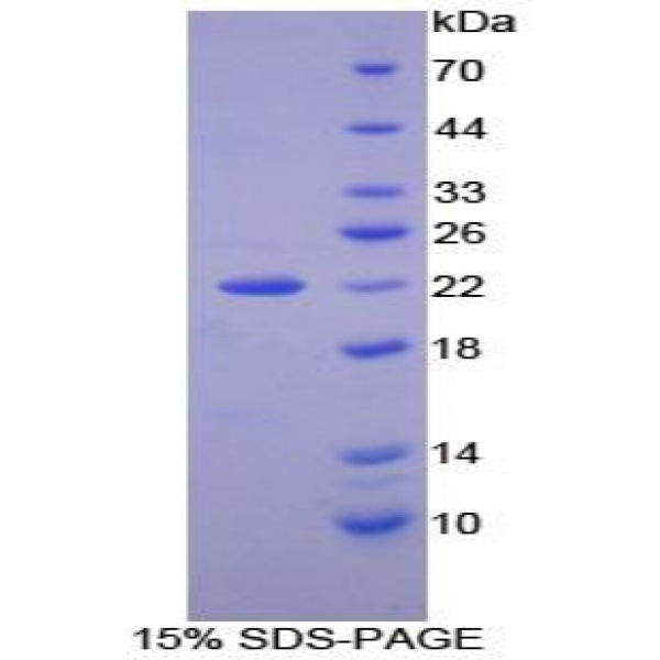集落刺激因子2受体β(CSF2Rb)重组蛋白(多属种)