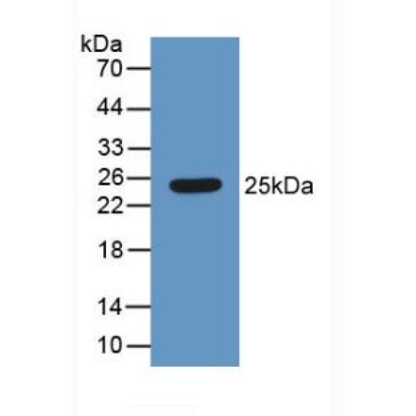 GATA结合蛋白4(GATA4)多克隆抗体