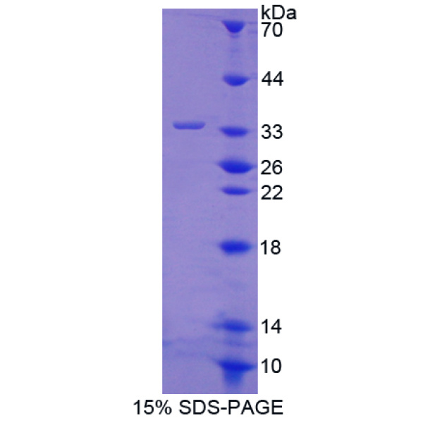 染色体结构维持蛋白3(SMC3)重组蛋白(多属种)