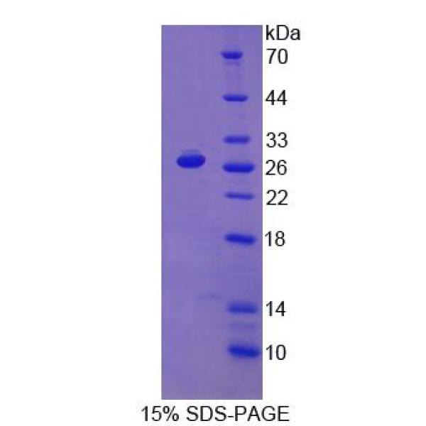 β-1,4-半乳糖转移酶1(b4GALT1)重组蛋白(多属种)