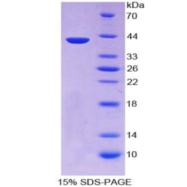 盘状结构域受体家族成员2(DDR2)重组蛋白(多属种)