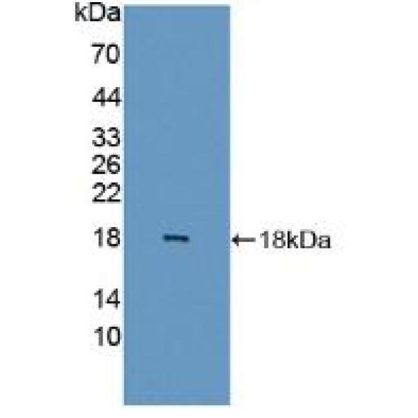 脂蛋白脂酶(LPL)多克隆抗体