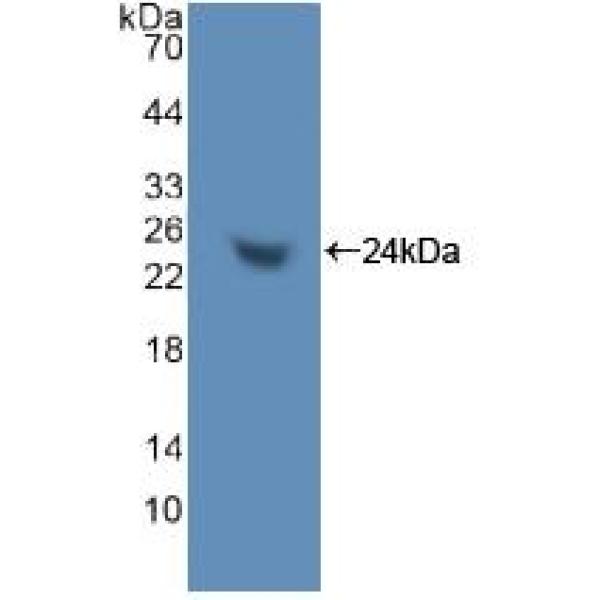 层粘连蛋白α1(LAMa1)多克隆抗体